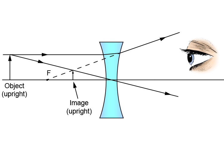 Ray diagram of a concave lens showing a virtual image